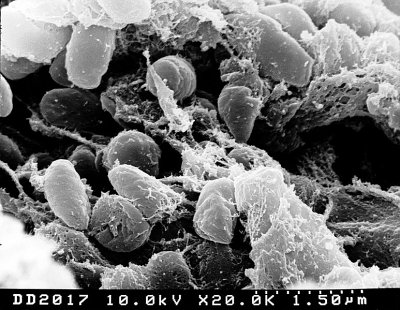 A scanning electron micrograph of the bacterium _Yersinia pestis_. This bacteria causes bubonic plague.