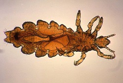 A photograph of the human head louse _Pediculus humanus_.
